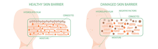 The Skin Barrier: What It Is and Why It Matters